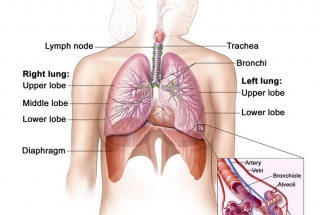 CÁC YẾU TỐ NGUY CƠ UNG THƯ PHỔI